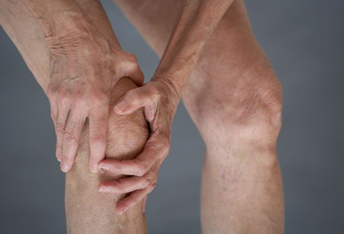 Jul - Osteoarthritis - Allure Wellness
