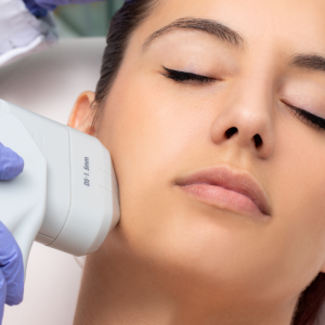 HIFU Face Lifting