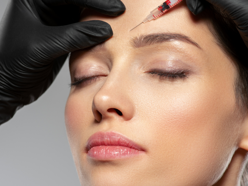 Aesthetic doctor administering Rejuran injection on woman's forehead for wrinkles