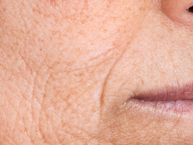 Detailed close-up of wrinkled skin showing natural aging effects