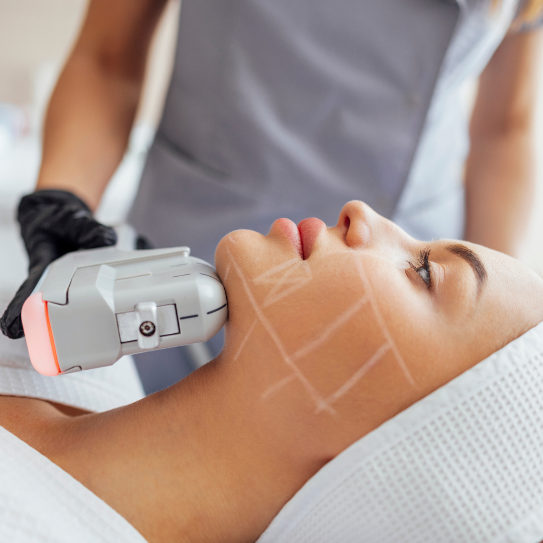 Benefits of HIFU