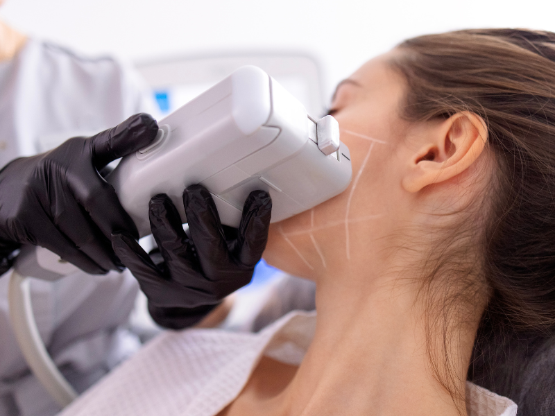 Aesthetician using a contouring device for jawline enhancement procedure