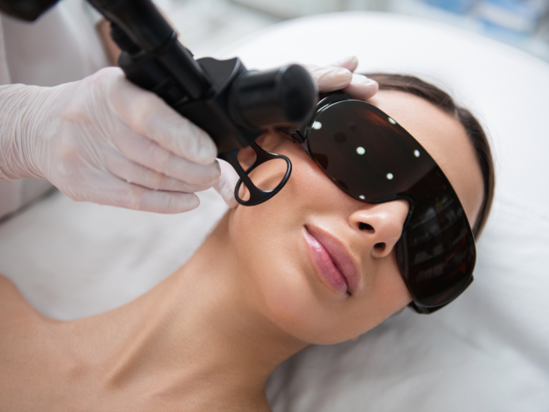 Woman receiving advanced laser facial treatment while wearing protective glasses