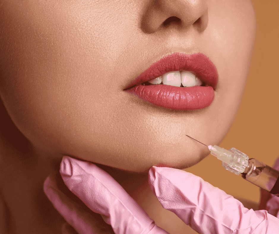 Chin Filler Transformation