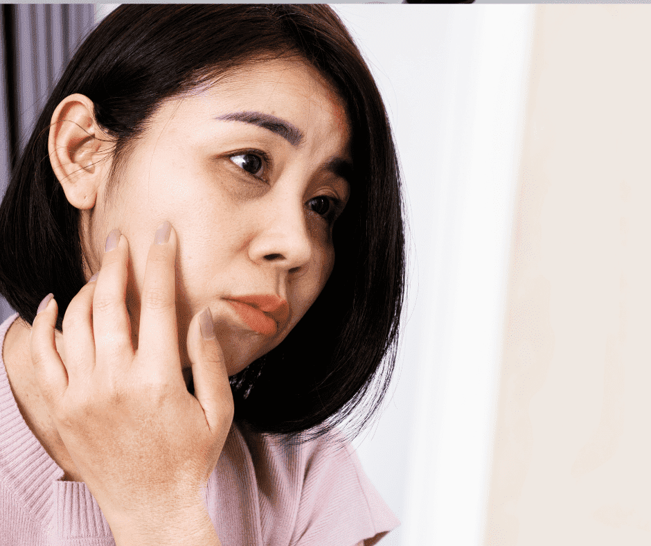 What Causes Dark Eye Circles?
