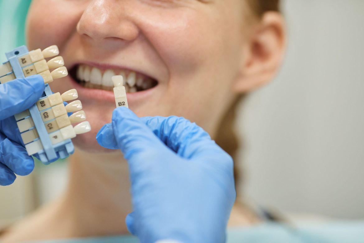 dentist comparing teeth for implants