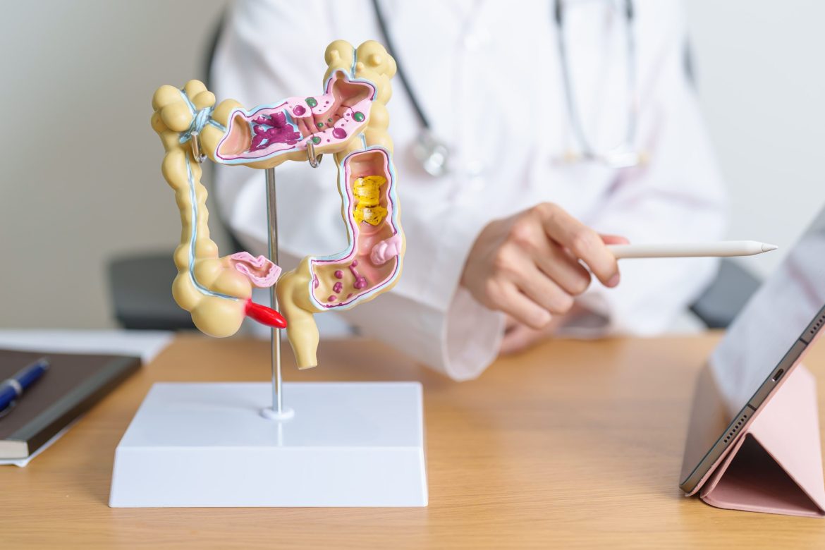 doctor showing a model of the human colon