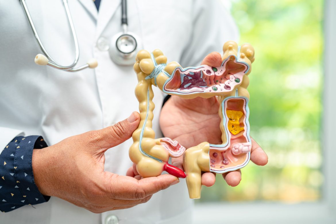 doctor showing a replica of the intestine and the digestive system