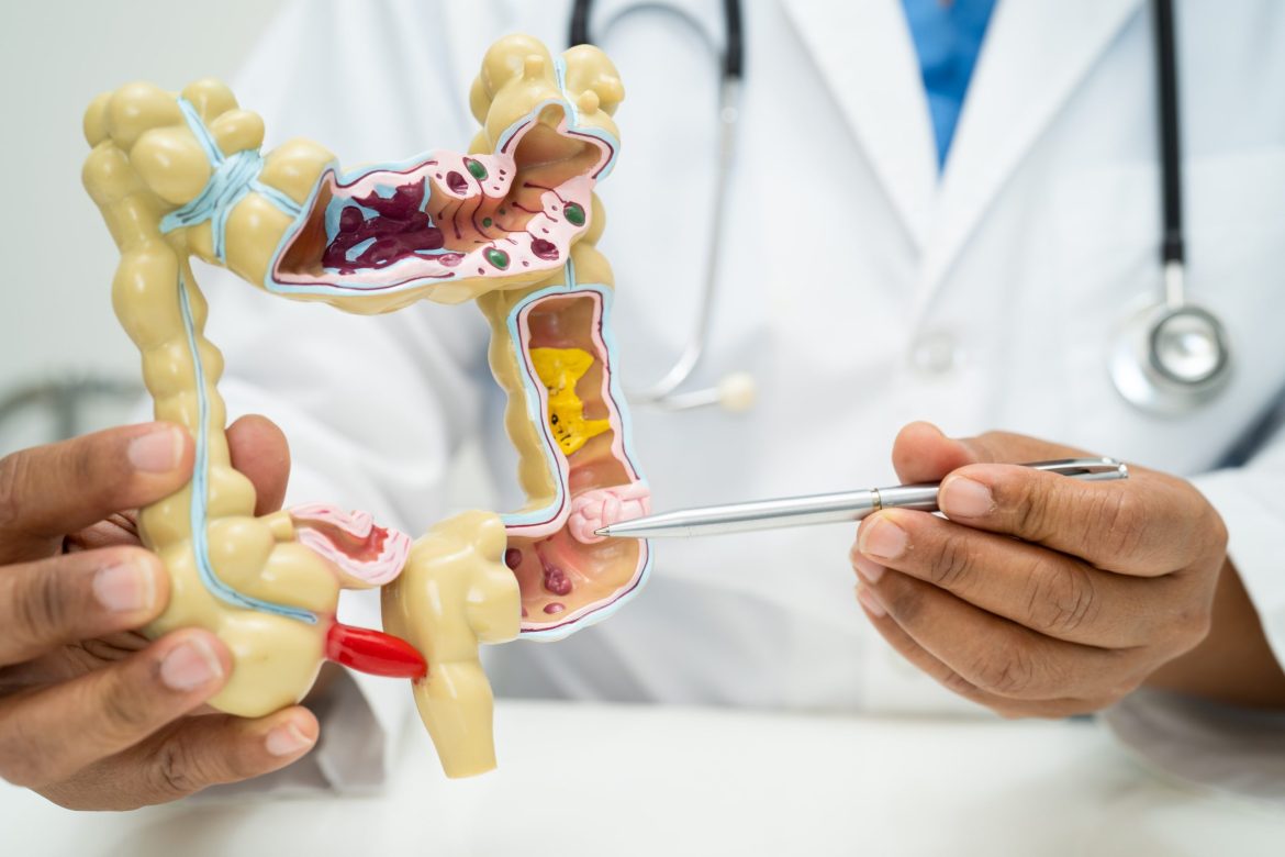 doctor holding a digestive system model