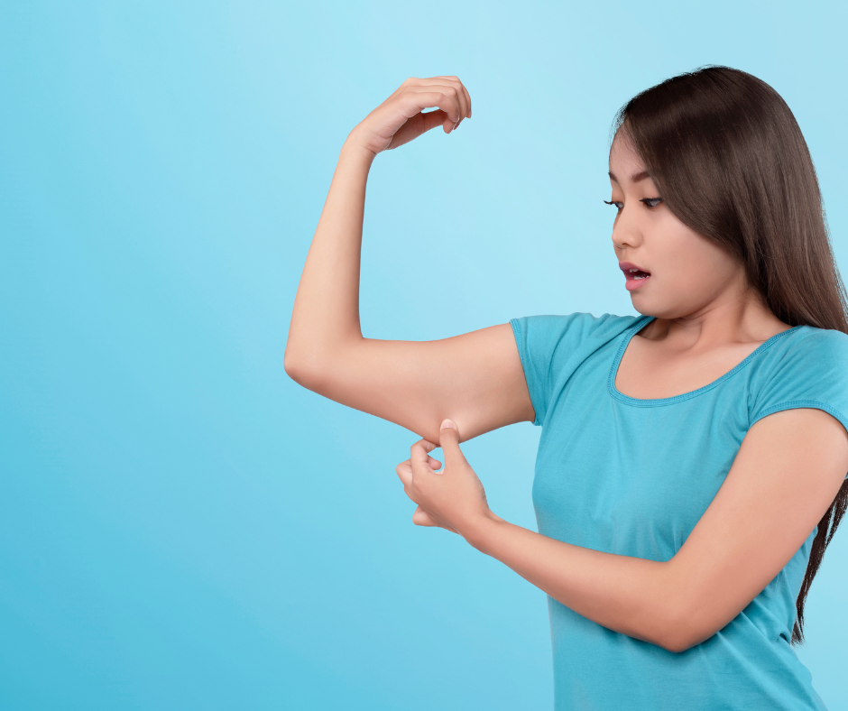 Woman pinching excess skin on her upper arm area