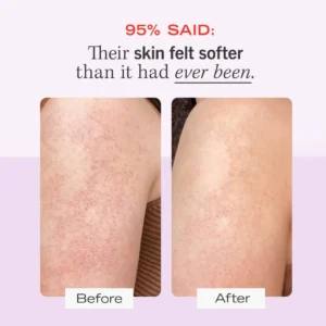 First Aid Beauty KP Bump Eraser Body Scrub before and after use